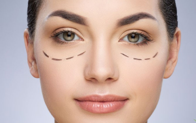 Non-surgical Under Eye Bag
Removal